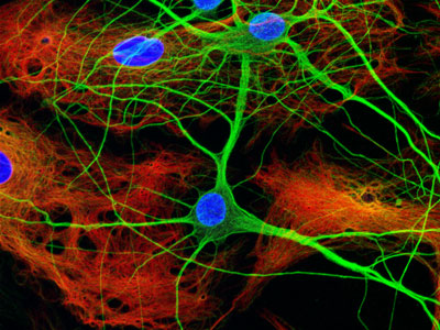 4844_Neuron-on-glia-.jpg‏