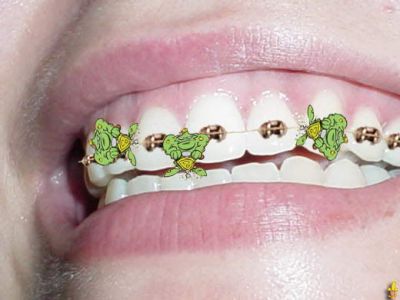 normal_teeth.jpg‏